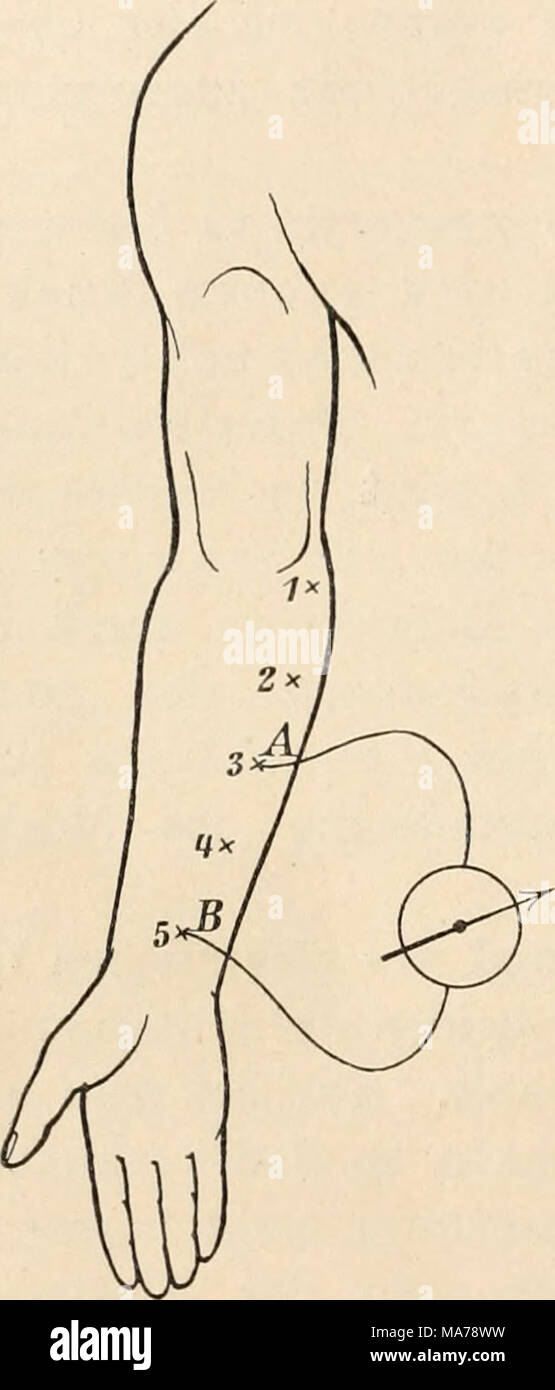 . Elektrophysiologie menschlicher Muskeln . Abb. 10. Die Punkte 1 bis 5 geben die Orte am Unterarm an, von denen paarweise abge- leitet wurde. A ist die obere, B die untere Ableitungselektrode zum Galvanometer. Stock Photo