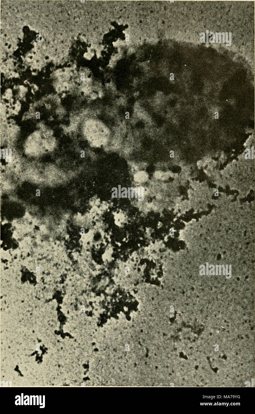 The Electron Microscope Its Development Present Performance And Future Possibilities Fig 30 Bacteriophage Anti Coli And Escjicrichia Coli X 35 000 The Picture Shows Complete Lysis Of The Bacterial Cell After 30