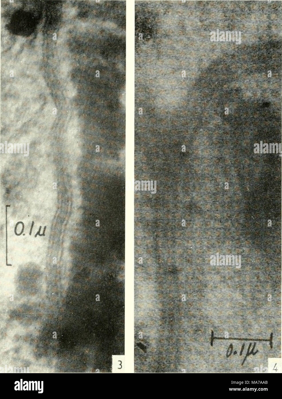 Membrane Cortex Complex . Electron microscopy; proceedings of the Stockholm Conference ...