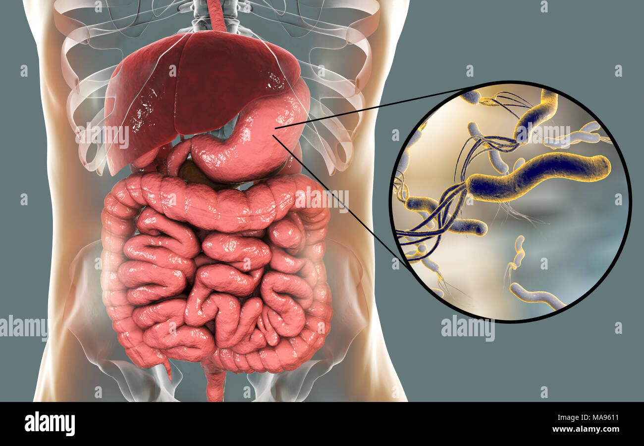Helicobacter pylori bacteria. Computer illustration of Helicobacter