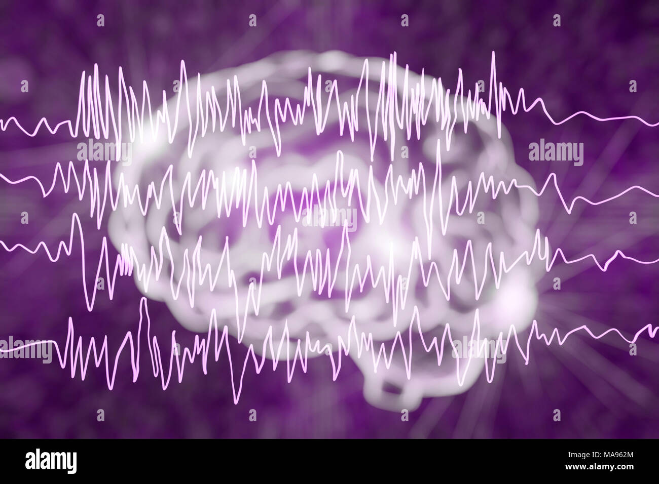 Brain and brain waves in epilepsy, computer illustration. This EEG