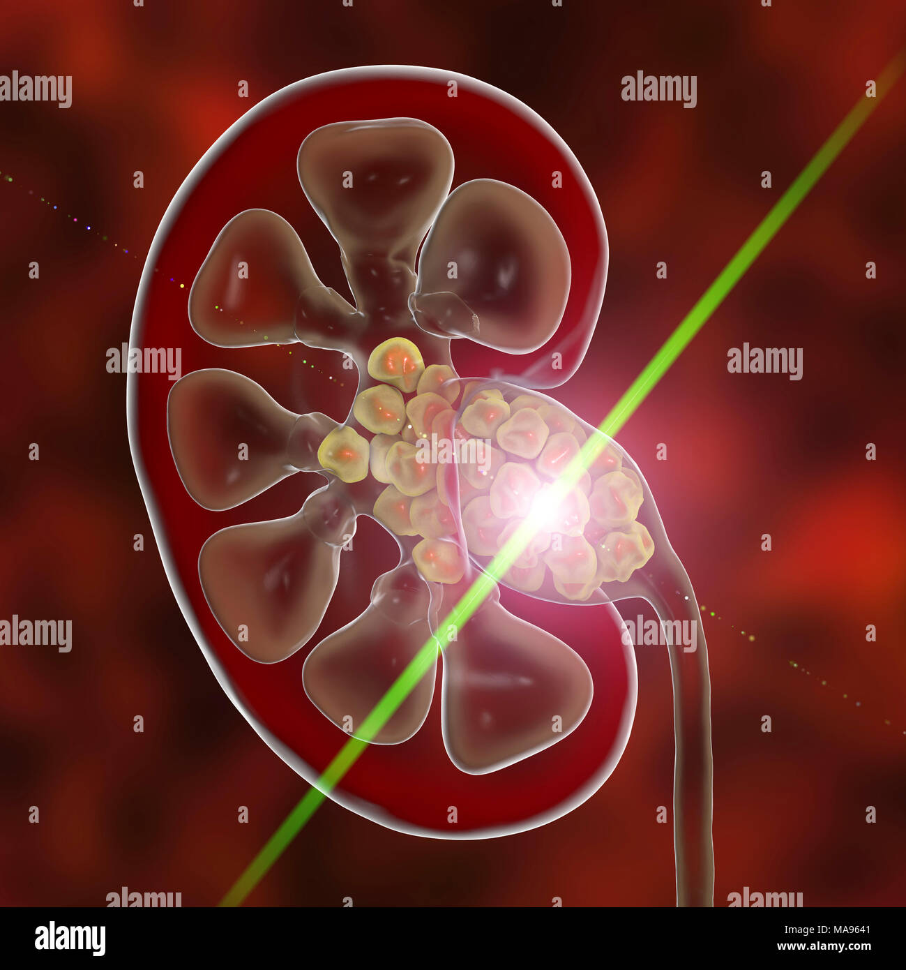 Kidney ultrasound hires stock photography and images Alamy