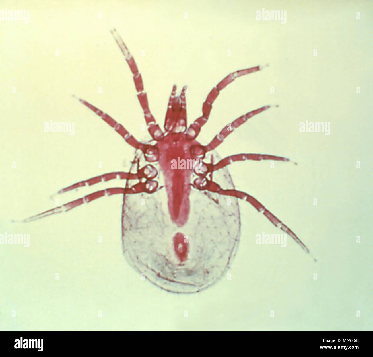 Mite, a member of the Class Arachnida, and the Order Acari, 1972. Image courtesy Centers for Disease Control (CDC). () Stock Photo