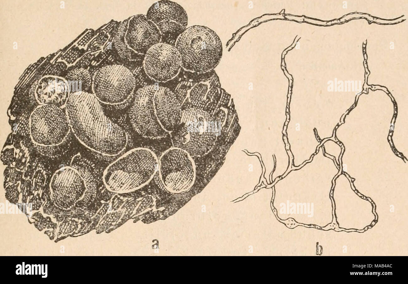 . Dr. L. Rabenhorst's Kryptogamen-Flora von Deutschland, Oesterreich und der Schweiz . Fig. 170. Perieh»na corticalis (Batsch) Rost. aj Sporaiigien (^^j); b) Cüpillitiunafäden (^&quot;/j; oberes Padeustück '&quot;'&quot;O;,). Nach Lister. var. affinis Lister Monogr. ed. 2 (1911), 251. Synonym: Perichsena populina Fr. var. affinis Lister ap. Meylan in Bull. Soc. Bot. Geneve 2me ser. II (1910), 267. Sporangien purpurrot oder rotbraun, unregelmäßig am Scheitel sich öffnend; Capillitium reichlich entwickelt, ein Netz- werk aus straffen, gelblichbraunen, 2—3 (a breiten Fäden. Sporen 10—12 ^. Schwei Stock Photo