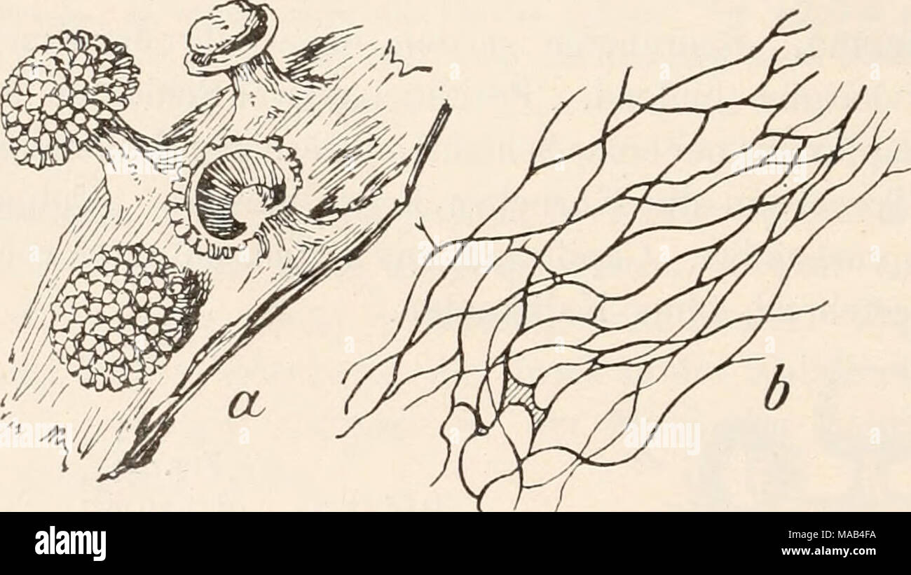 . Dr. L. Rabenhorst's Kryptogamen-Flora von Deutschland, Oesterreich und der Schweiz . Fig. 50. Physarina echinocephala (nach Lister). a) Vier am Substrat befestigte Sporangien, eines längs durchschnitten, die Columella zeigend, eines mit verschwundener Peridie, der Stiel überragt von der Columella ('5/i). b. Ein Teil des Capillitiums (260/j). Diacha^a. Gestielte oder ungestielte Sporangien oder Plas- modiokarpien. Peridie häutig, irisierend, ohne Kalkeinlagerungen, Stiel und Columella kalkführend, selten kalkfrei. Capillitium ein weitmaschiges Netzwerk purpurroter Fäden ohne Kalkknoten. Stock Photo
