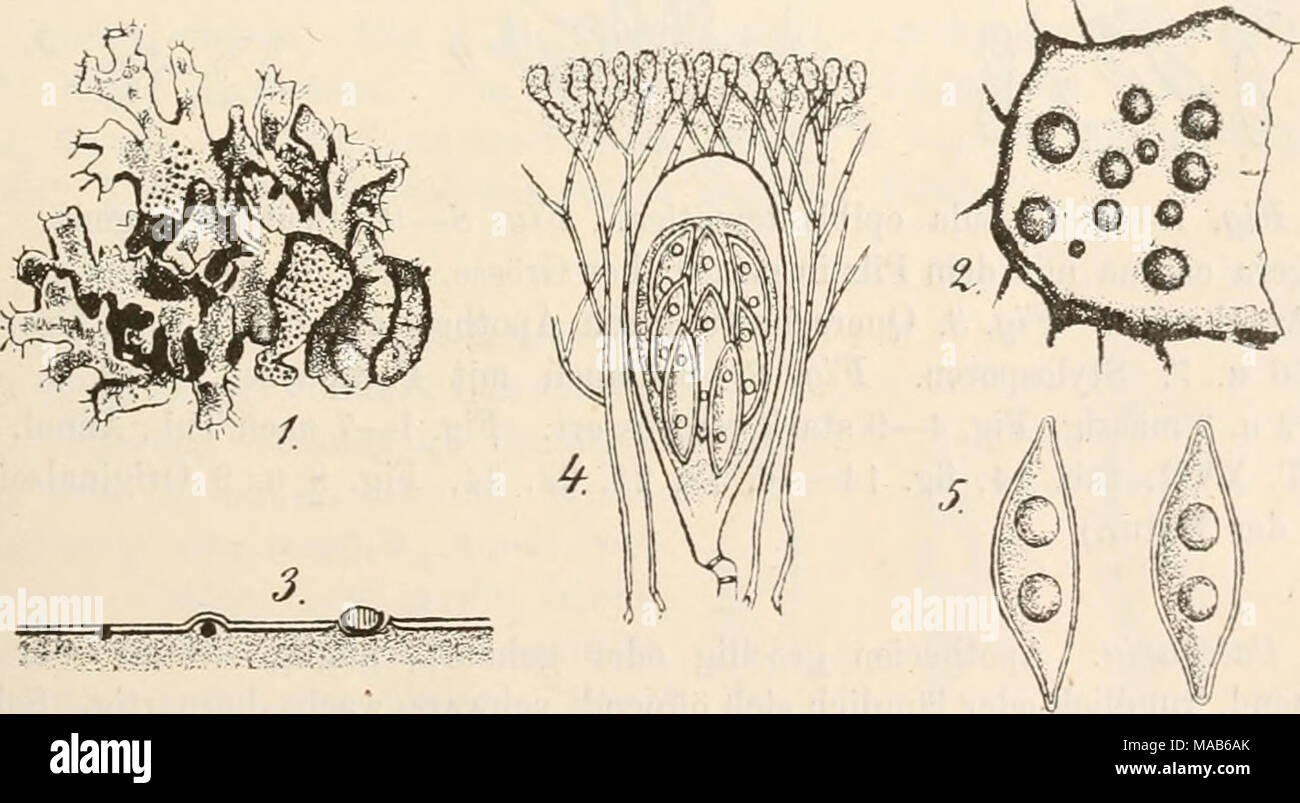 . Dr. L. Rabenhorst's Kryptogamen-Flora von Deutschland, Oesterreich und der Schweiz . Fig. 1—5. Nesolechia oxyspora. Fig. 1. Parmelia saxatalis mit dem Pilz in natürlicher Grösse. Fig. 2. Ein Stück der Flechte mit Apothecien des Parasiten. Fig. 3. Querschnitt durch Apothecien. Fig. 4. Schlauch mit Paraphysen. Fig. 5. Sporen. (Fig. 2 massig, Fig. 4 u. 5 stark vergrössert. Sämmtlich Originalzeichuungen nach der Natur. Stock Photo