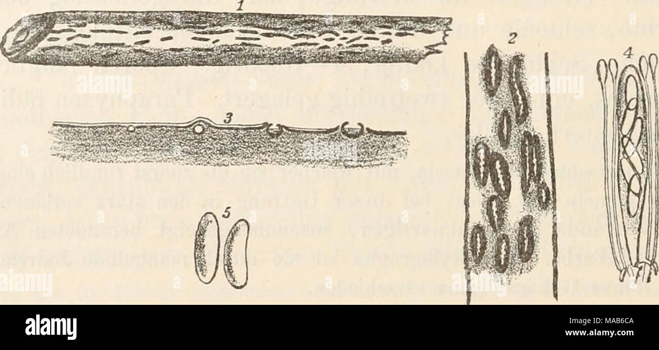 . Dr. L. Rabenhorst's Kryptogamen-Flora von Deutschland, Oesterreich und der Schweiz . Fig. 1—5. Briardia purpurascens. Fig. 1. Stengel von Chenopodium album mit dem Pilz in natürlicher Grösse. Fig. 2. Apothecien von oben gesehen. Fig. 3. Querschnitt durch Apothecien. Fig. 4. Schlauch mit Paraphysen. Fig. 5. Sporen. (Fig. 2 u. S etwas, Fig. 4 u. b stark vergrössert. Alles nach der Natur.) Eine wunderschöne, durch die länglichen, rothen, im trockenen Zustande Hysterium-artigen Apothecien sehr charakteristische Art, welche möglicher Weise identisch ist mit Hysterium rubrum Pries, Sclerom. exs. 4 Stock Photo