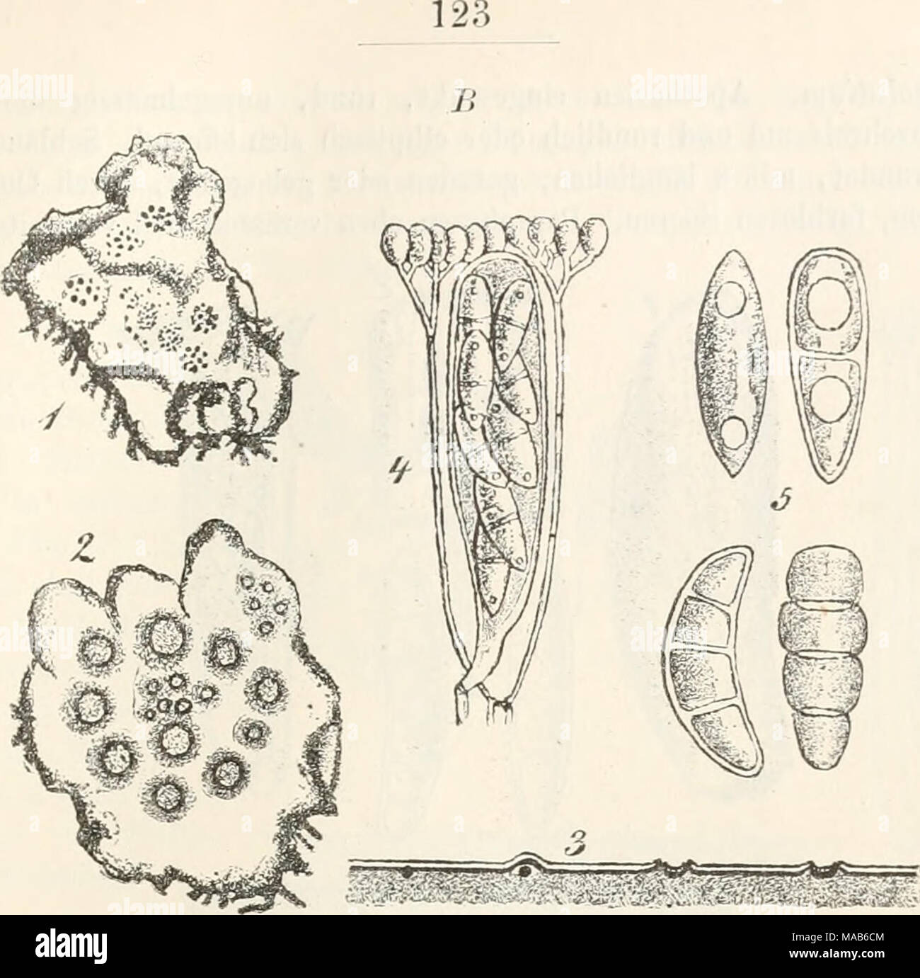 . Dr. L. Rabenhorst's Kryptogamen-Flora von Deutschland, Oesterreich und der Schweiz . B. Fig. 1—5. Phragmonaevia Nylanderi. Fig. 1. Peltigera-Thallus mit dem Pilz in natürlicher Grösse (trocken). Fig. 2. Ein Stück davon mit Apothecien Fig. 3. Querschnitt durch Apothecien. Fig. 4. Schlauch mit Paraphysen. Fig. 5. Sporen. (Fig. 2 u. 3 massig, Fig. 4 u. 5 stark vergrössert. Sämratlich Original- zeichnungen nach der Natur.) Stock Photo