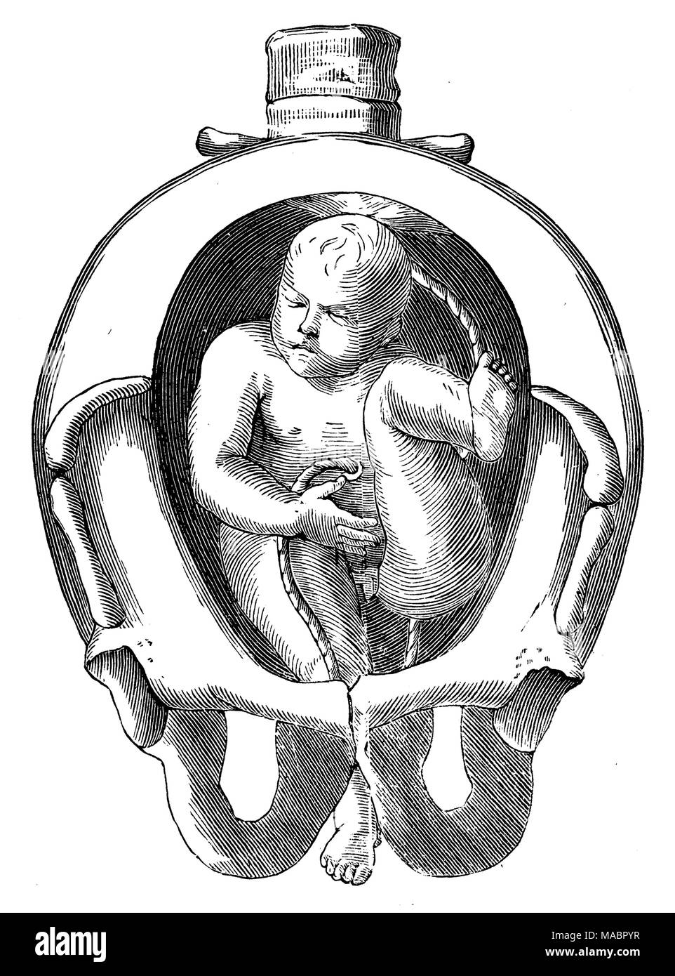 Location of a child in the uterus: Prolapse of the right foot Stock Photo