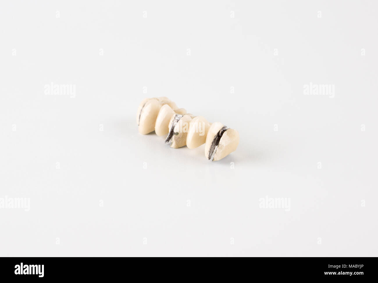 Denture damage from ceramic mass on a white background Stock Photo