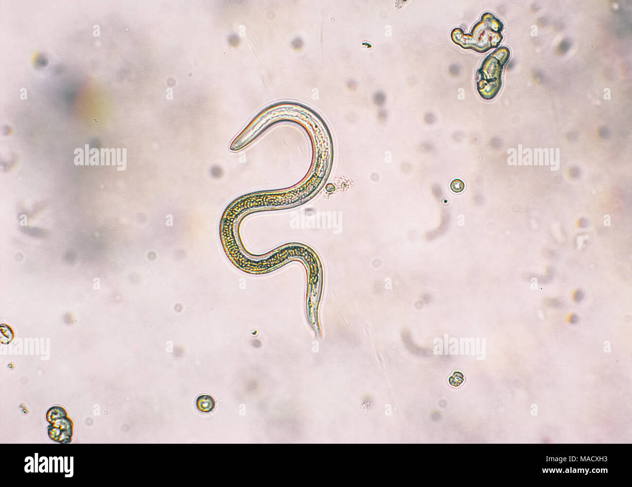 Toxocara canis second stage larvae hatch from eggs in microscope. Toxocariasis, also known as Roundworm Infection, causes disease in humans Stock Photo