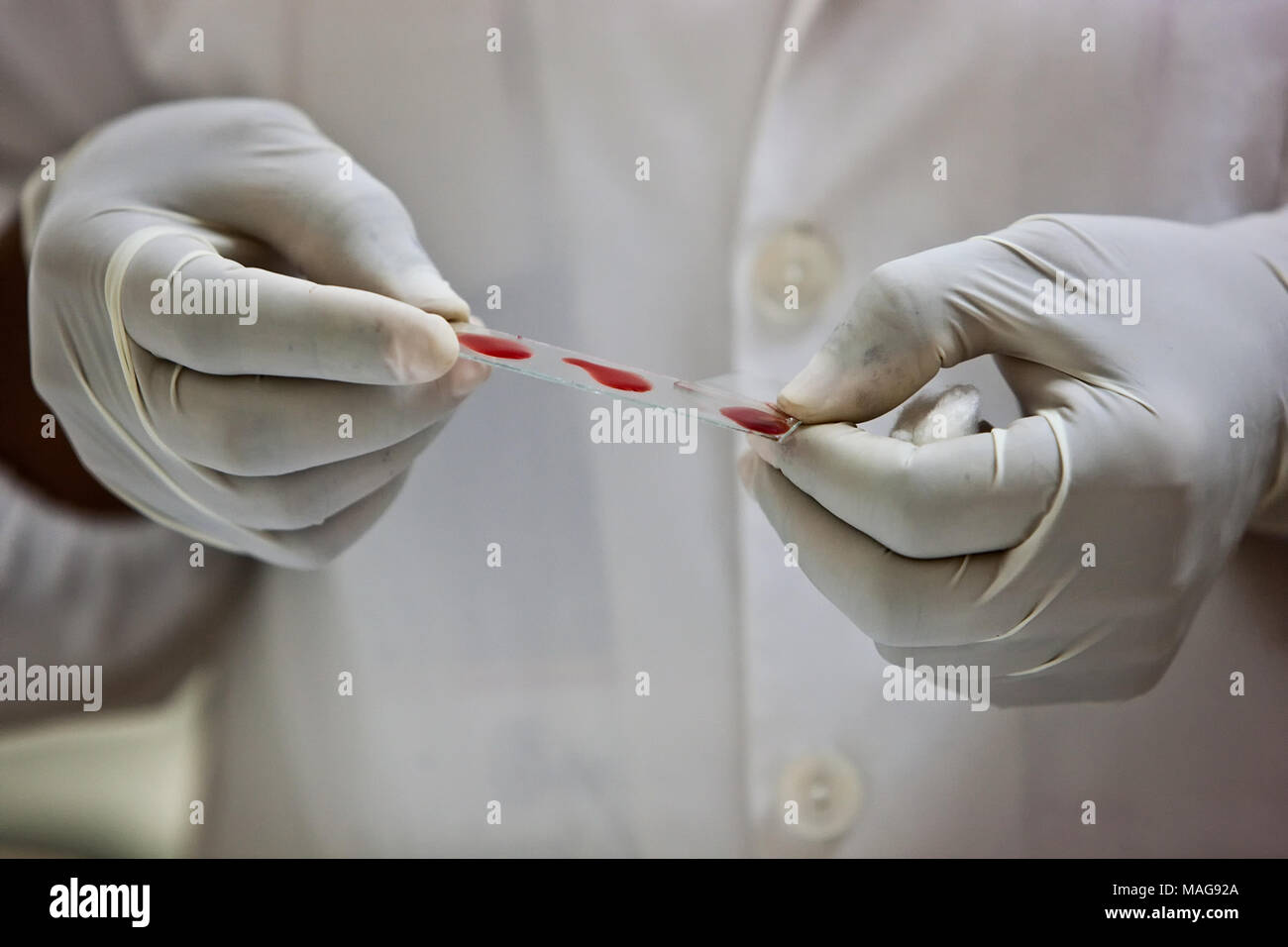 Hands of doctor holding blood test plates Stock Photo - Alamy
