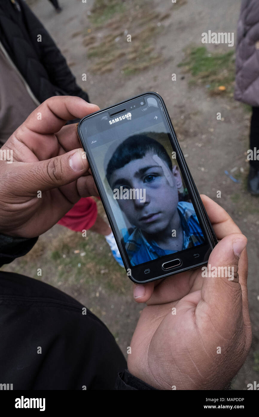 Krnjaca refugee camp. An Iraqi man shows pictures of his son after he was assaulted by the Bulgarian police. Stock Photo