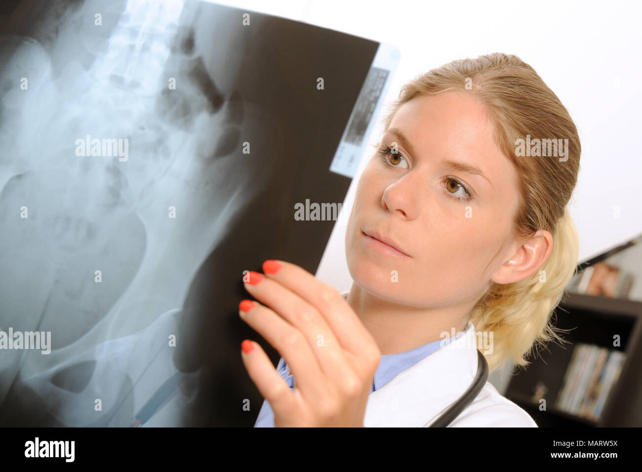 Adult female chest x ray hi-res stock photography and images - Alamy