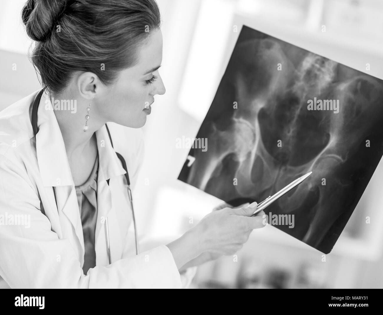 Medical doctor woman pointing on fluorography Stock Photo