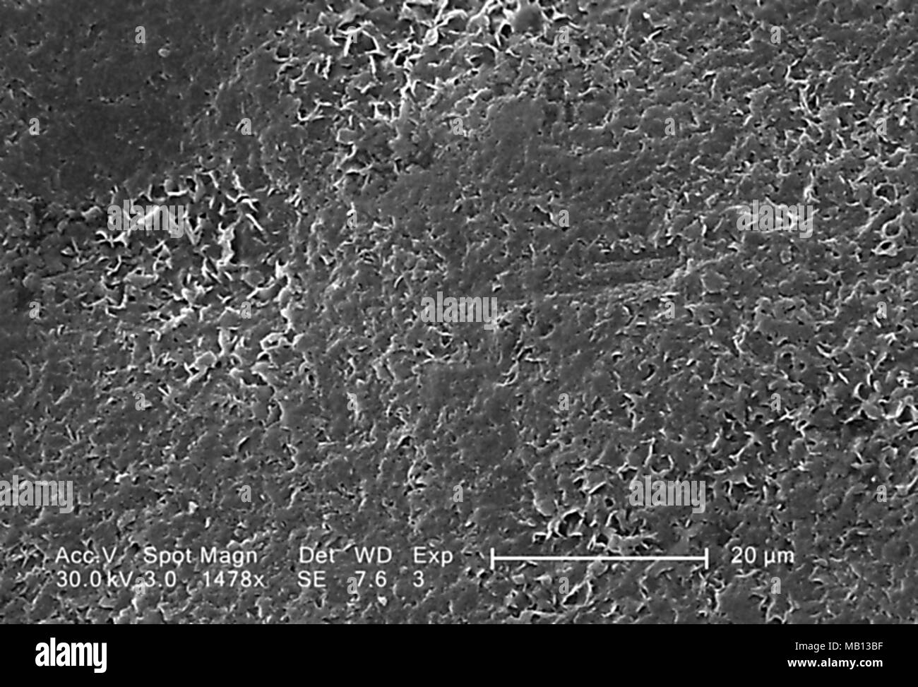 Rough surface of a Vitis specimen white table grape revealed in the 2955x magnified scanning electron microscopic (SEM) image, 2005. Image courtesy Centers for Disease Control (CDC). () Stock Photo