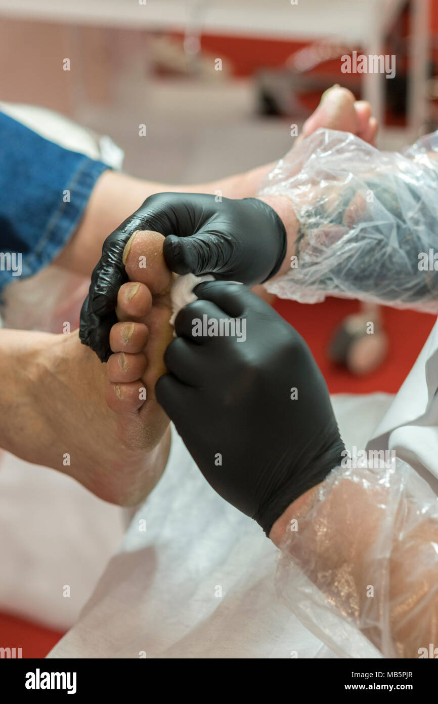 Podiatry doctor. Treatment of feet and nails Stock Photo Alamy