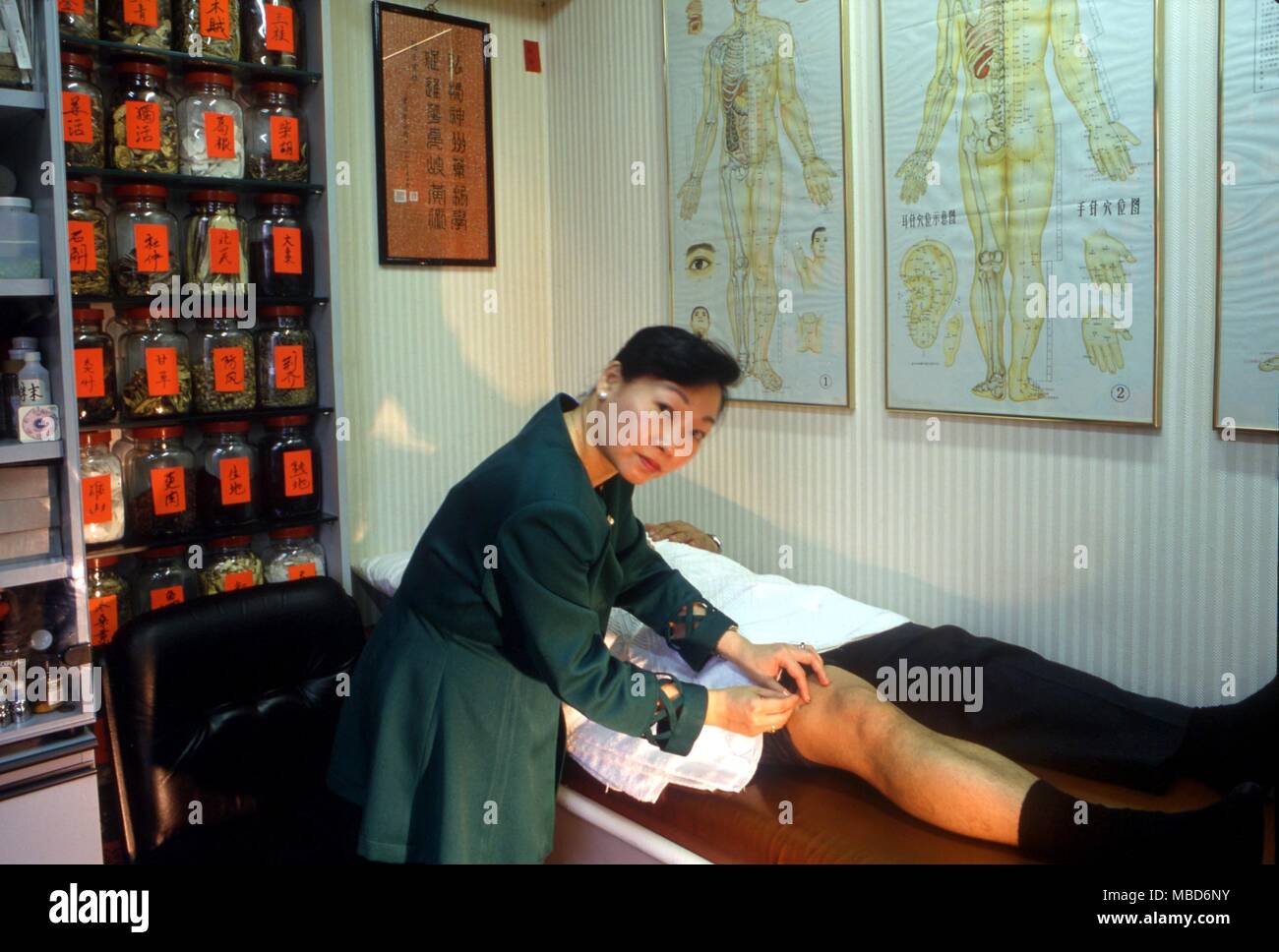 ACUPUNCTURE Female Chinese doctor practising acupuncture on a patient