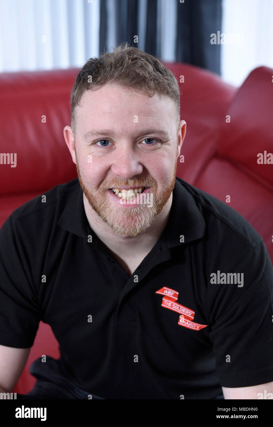 Philip Gillespie From Ballymena Northern Ireland Has Received An