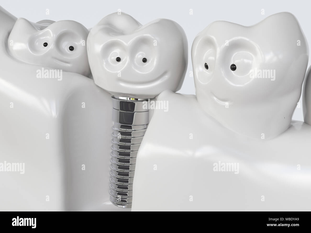 Tooth human cartoon implant - 3D Rendering Stock Photo
