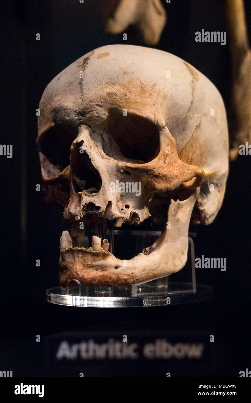 Human skull from wreck of the Mary Rose; warship of English Tudor navy of King Henry VIII. The Mary Rose Museum, Historic Dockyard, Portsmouth. UK Stock Photo