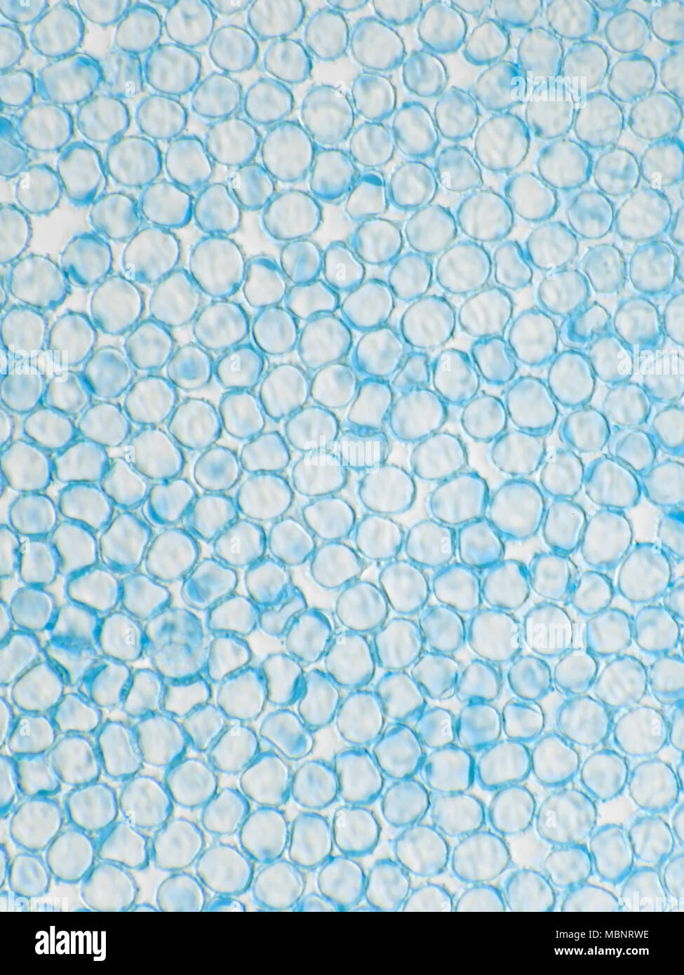 Light micrograph of Lactarius rubrilacteus (bleeding milkcap) mushroom spores, field of view is approximately 120 micrometers tall Stock Photo
