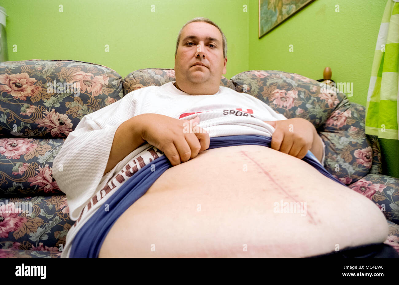 A Man Who Was Addicted To Coca Cola At One Point Drinking 60 Cans Per Day Stock Photo Alamy