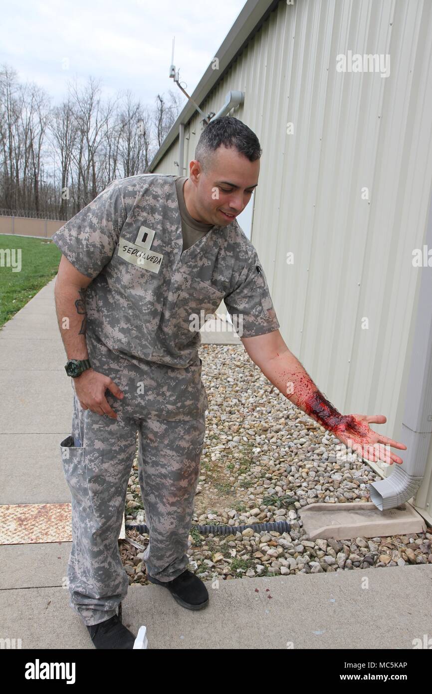 1Lt. Enrique Sepulveda with the Medical Readiness Training Command, based in San Antonio, Texas, shows off a road rash type wound on his forearm he created using gel effects in moulage class during Guardian Response 18 at Muscatatuck Urban Training Center, Ind., April 6, 2018. Moulage is the technique of creating and producing precise and detailed patient casualty scenarios with medical knowledge and trained artistic abilities.    More than 4,500 Soldiers from across the country are participating in Guardian Response 1, a multi-component training exercise to validate U.S. Army units’ ability t Stock Photo