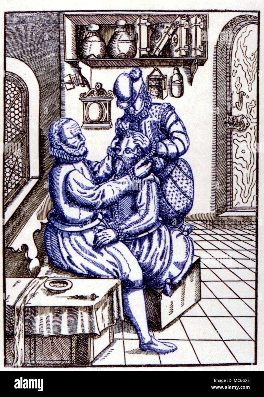 MEDICAL - EYE OPERATION. Print after the woodcut from Georg Bartisch, 'Opthalmodouleia, Das ist Augendienst, Dresden, 1583 Stock Photo