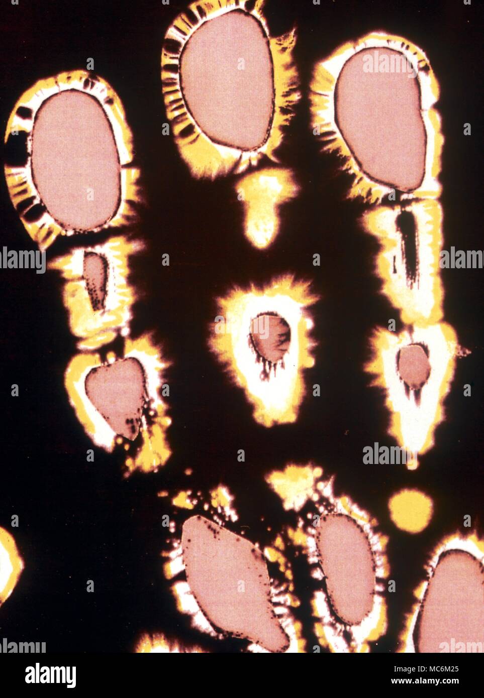 Detail of fingerprints Kirlian image after computer colour enhancement.. Some occultists (wrongly) insist that these are the equivalent of the aura, or even of the astral body. Stock Photo