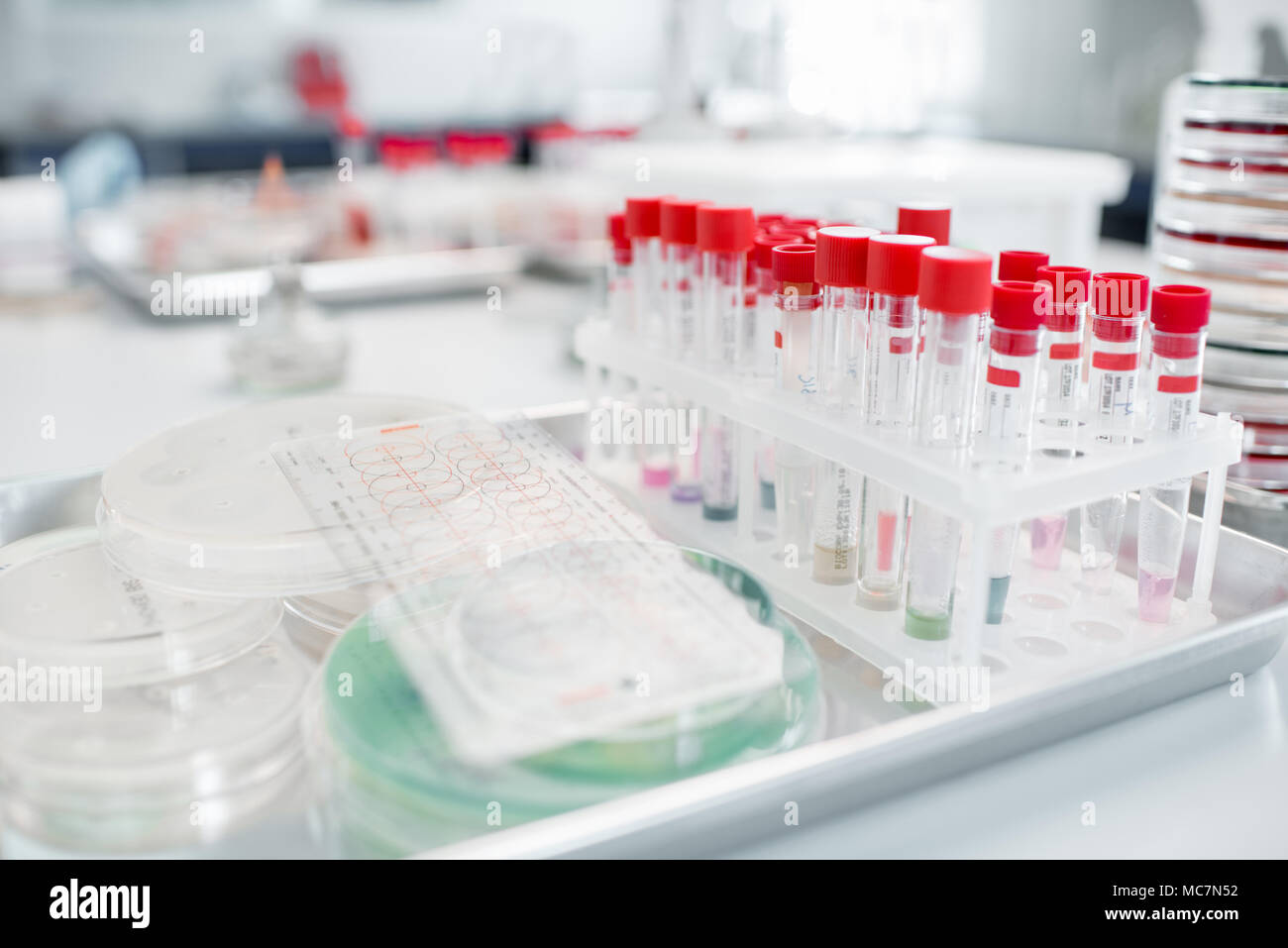 Test tubes with Petri dishes on the table in bacteriological department