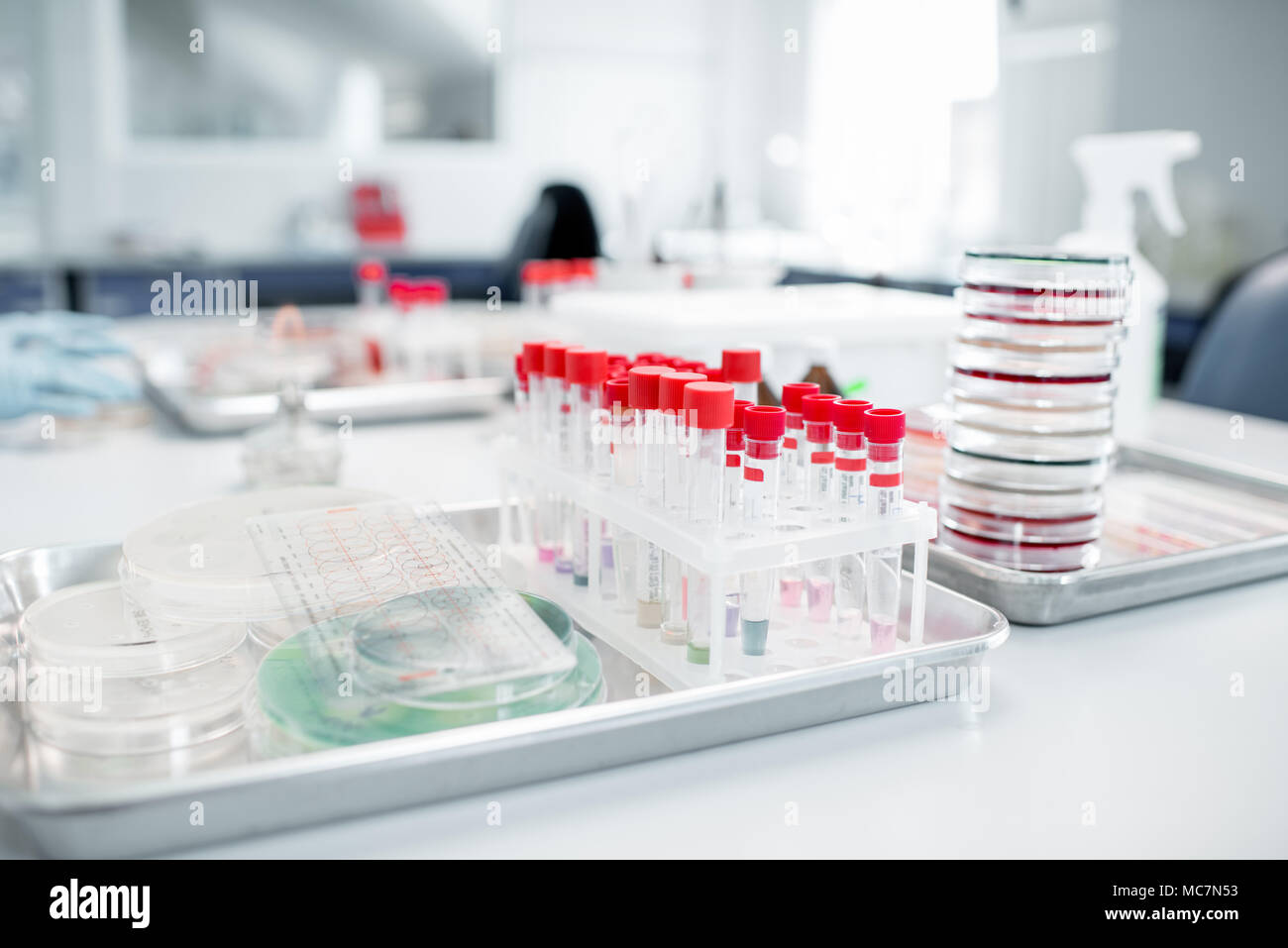 Test tubes with Petri dishes on the table in bacteriological department ...