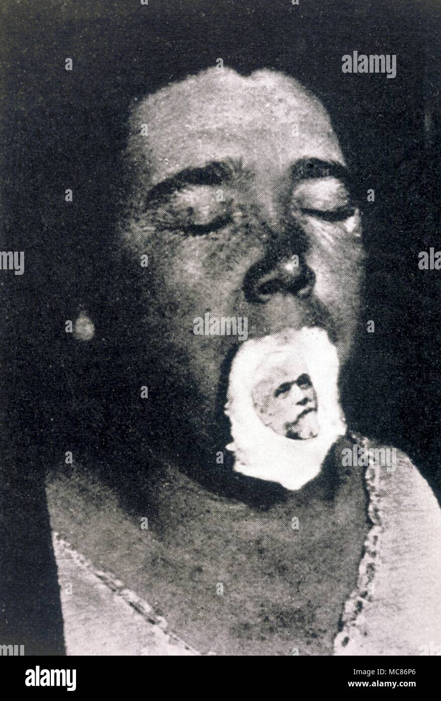 PSYCHIC PHENOMENA - TELEPLASM Teleplasm, or ectoplasm, surrounding a portrait of a 'spirit' face identified as being that of the medium's father. Photographed in September, 1928, in Winnipeg Stock Photo