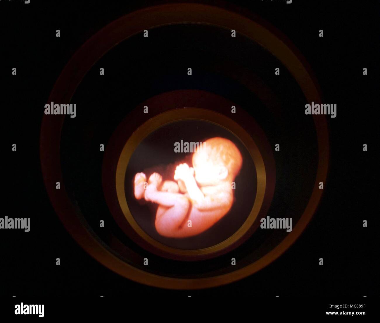 Reincarnation The embryo as representation of the spirit descending into incarnation from the spiritual realms Stock Photo