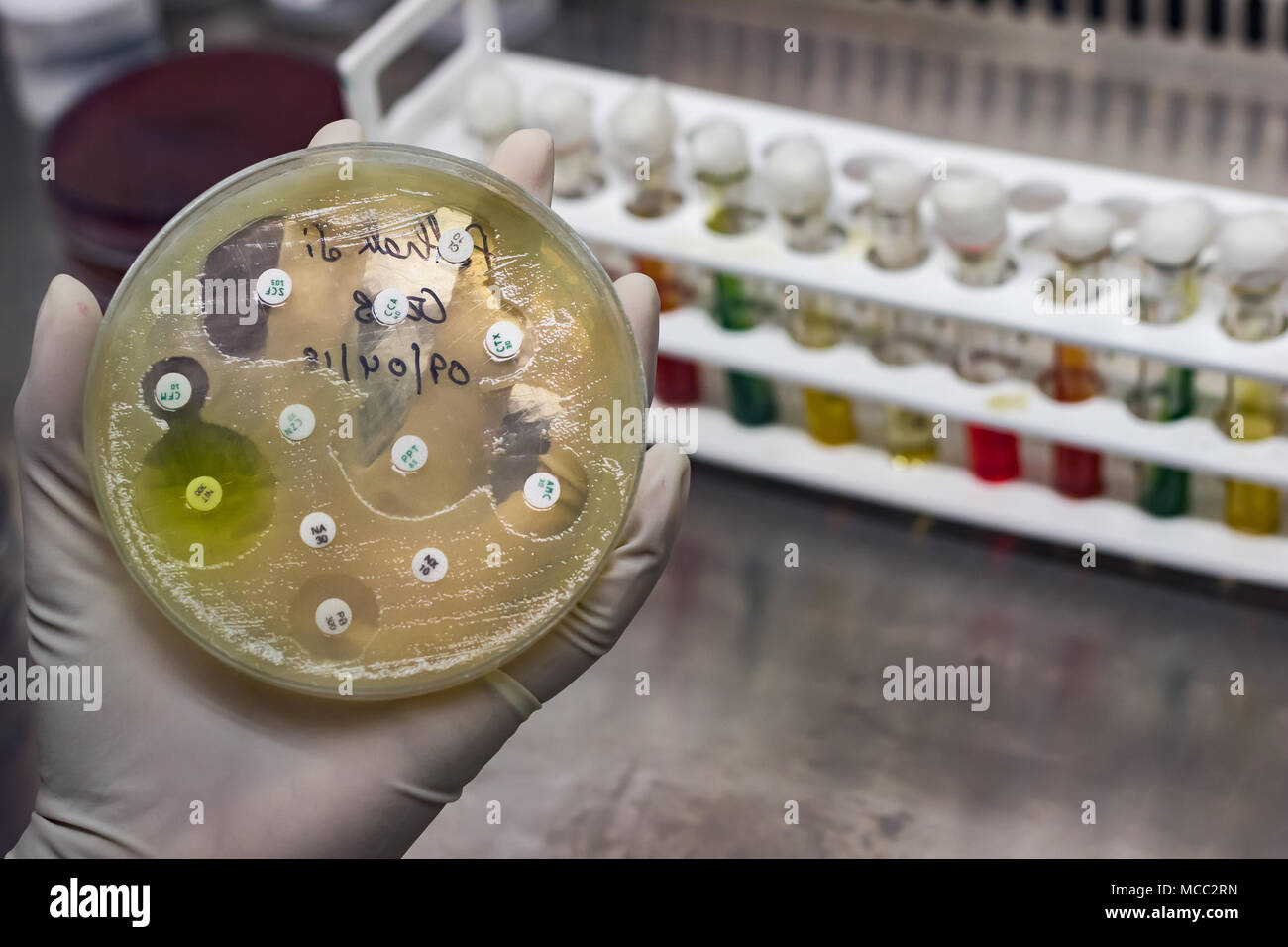 Top view of Culture plate of bacterial growth showing antibiotic sensitivity in their colony pattern placed geld in gloved hand Stock Photo