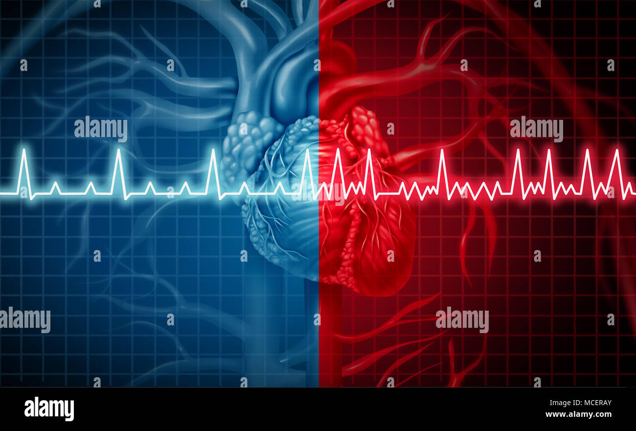 Atrial fibrillation and normal or abnormal heart rate rythm concept as a cardiac disorder as a human organ with healthy and unhealthy ecg. Stock Photo