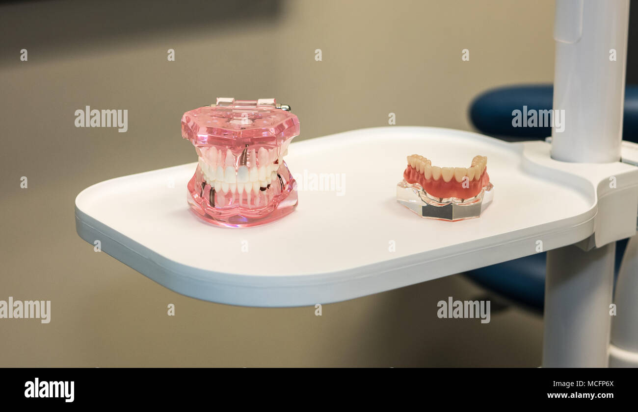 Upper and lower jaw models on a tray used in dentistry as educational tools. Stock Photo