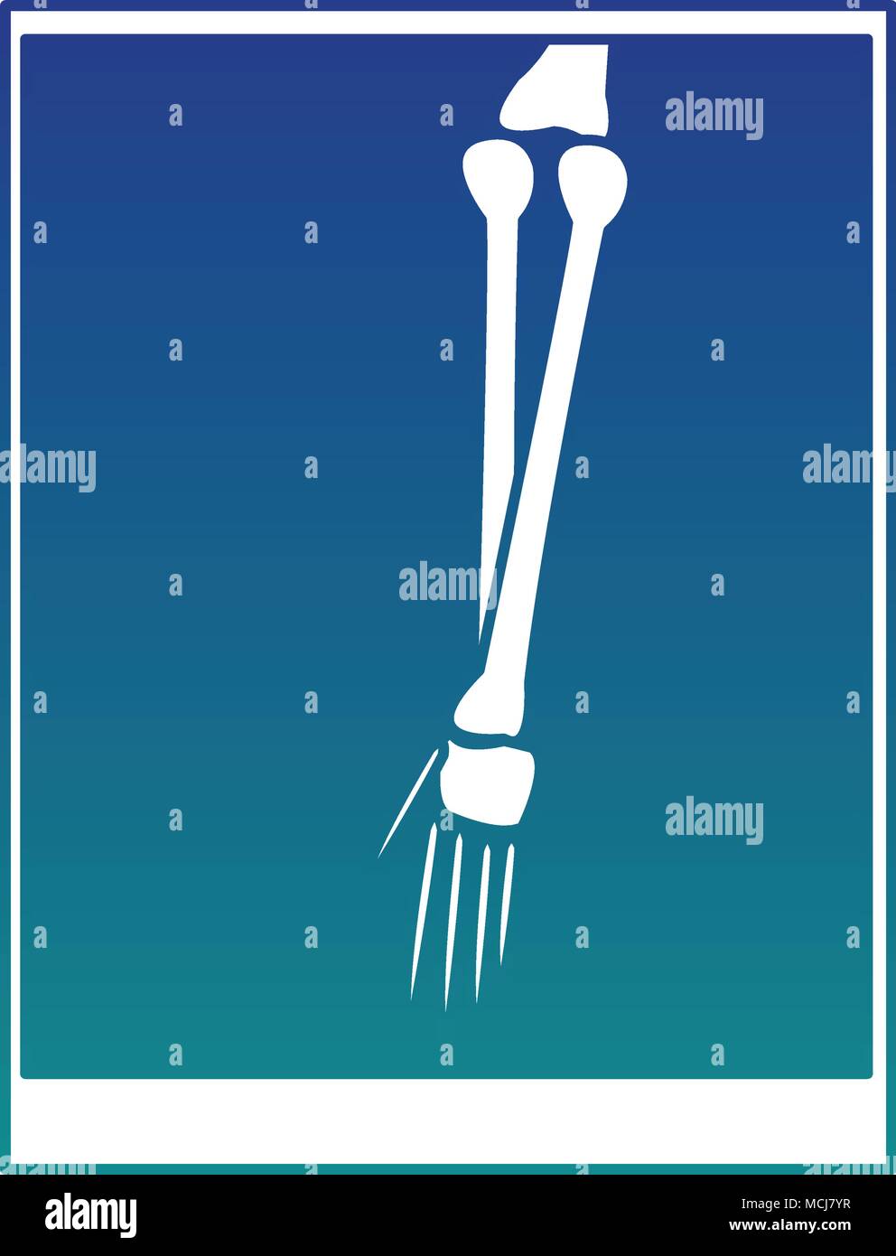 Xray bones images blue lines Stock Vector Image & Art Alamy