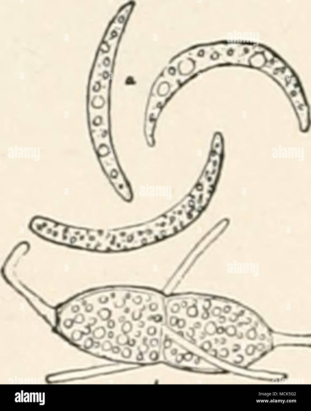. Fig. 113.—a, Conidia ; h, asco- spore of Aglaospora toJ.eolo. ( X -^f^). (After Hartig.) superficially abjointed from the stromata; while embedded in it are groups of perithecia with necks which join together into one or a few common channels opening externally. The asci contain eight spores, which are two-celled and bear five thread-like appendages, one on each end, and three round the median septum (Fig. 113). Stock Photo