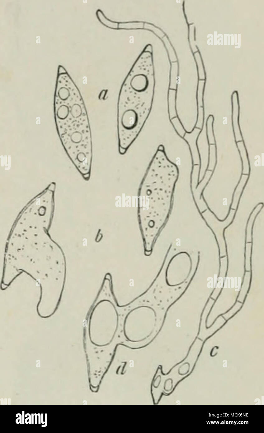 . Fio. 147.âAscospores of Rhizina. a, As taken from the ascus; h, 24 hours after sowing; c, 48 hours after sowing; d, the spore of c enlarged. (After Hartig.) filled up. Masses of fungoid pseudoparenchyma are frequently formed between the dead and diseased tissues. Strands of the nature of Bhisoctonia emerge from the diseased roots, many of them carrying thread-like processes, at the extremity of which an oil-drop is secreted and escapes on rupture of the apex. According to Hartig, very tiny conidia are abjointed from the mycelium. De la Boulage^ and Prillieux have both come to the conclusion  Stock Photo