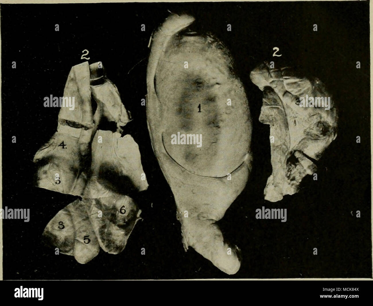 FiG. 122—Degenerative (Atrophic) Orchitis in Young- Bull. /, Normal testis  ; 2, atrophic degenerate testes ; j, body of atrophic gland ; 4, head and, j,  tail of epididymis ; (5