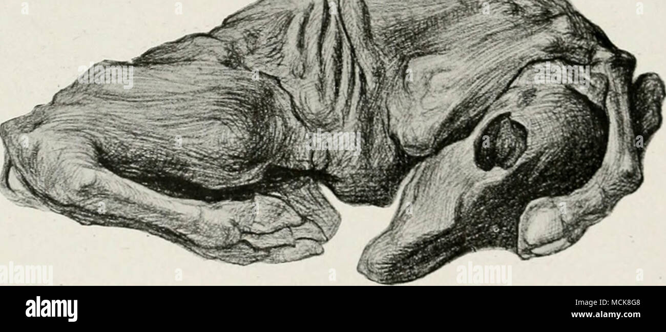 . Fig. i68—Complete Desiccation of Fetus following-Inter- Placental Henaorrhage. up to the completion of the process, shown in Y'lg. 168. Then one may palpate per rectum the limbs, ribs, head, hollow orbits, and all skeletal details. The completion of the desic- cation will naturally vary. In a fetus twenty-four inches long from nose to base of tail, I think the completion of the process requires six to eight months. Bang has procured cultures of the B. abortus from the desiccated debris. He does not state that other bacteria were or were not present. I am not aware of other bacterial search. Stock Photo