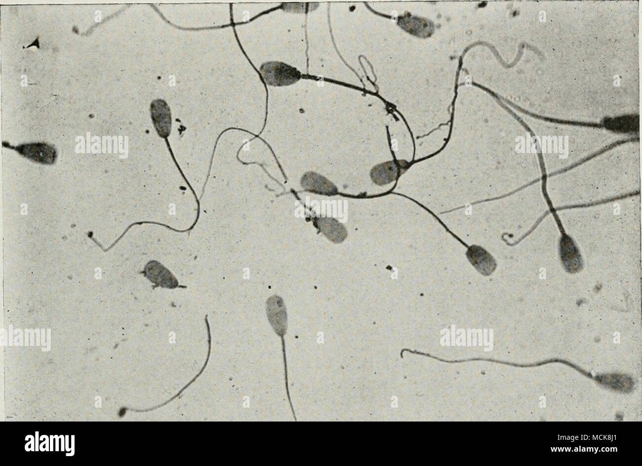 M Fig. 117. Spermatozoa from Bull No. 8. Cells show degeneration, as  indicated by want of definition of the nucleus. Some cells are abnormally  large. was narrower than normal and the