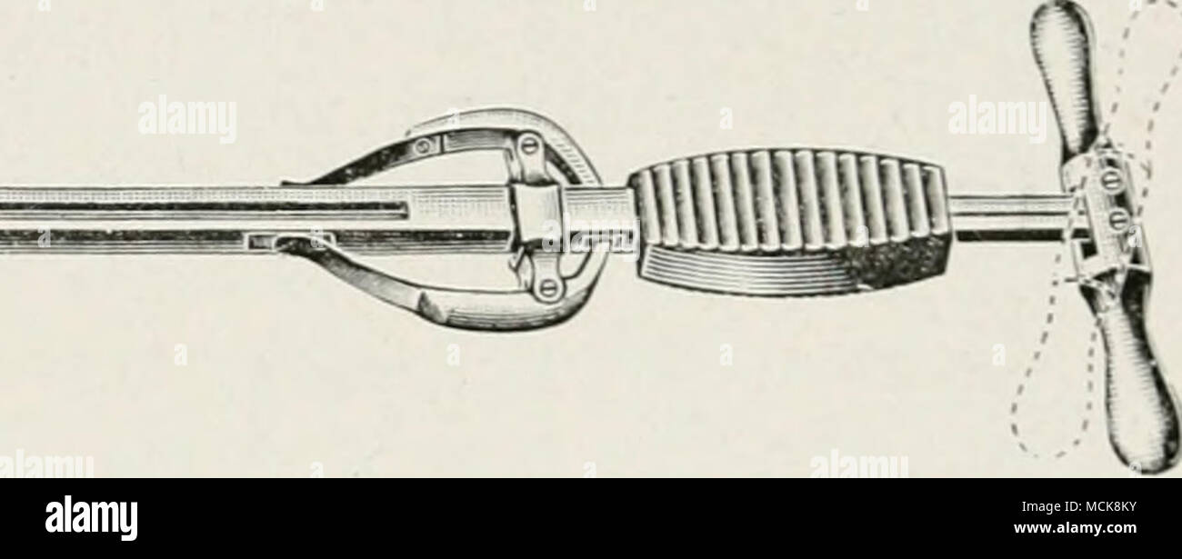 . Fig. 75—Special spaying ecraseur, 55 cm. long. in the standing position. (2) On the quiescent organ in the recumbent position under anaesthesia : 1. Without anaesthesia. Secure in the stocks with the head elevated, a rope over the back to prevent rearing, straps beneath the body to prevent lying down, straps or ropes before and behind the animal to prevent backward and forward movements, all four feet pinioned to the floor, and the tail firmly secured and stretched to a beam above. Apply a bandage to the tail extending 12 to 15 inches from its base, in order to secure the tail hairs out of t Stock Photo
