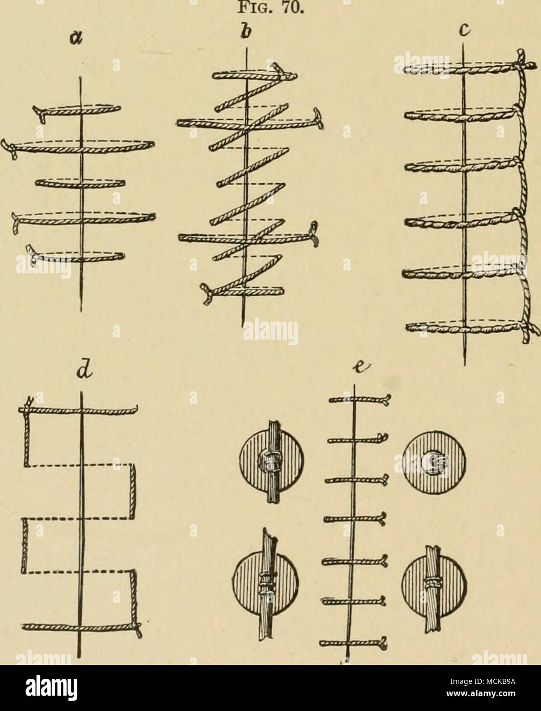 . Different forms of stitches used in the dog and method of tying : a, head-stitch ; &amp;, con- tinuous oblique stitch with cross-stitch ; c, deep continuous cross stitch ; d, mattress-stitch; e, button and interrupted stitch. Wounds which can heal hy first intention, such as all operative wounds which have been thoroughly disinfected according to the method described above, and where the hemorrhage has been Stock Photo