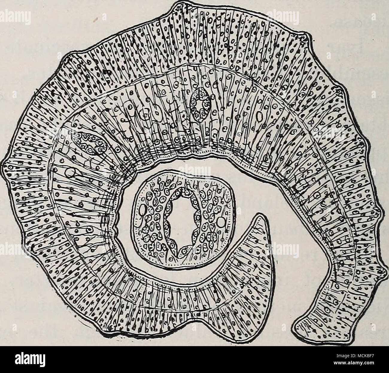 . Fig. 207.—Cross section of bovine blood fluke {Schistosoma bovis), showing the position of the female in the gynaecophoric canal. X 200. (After Leuckart, 1894, p. 472, Fig. 209.) the consequent location of the agglomeration of eggs, determine the jDarticular symptoms. Either the genito-urinary system is attacked, in which case heematuria is one of the first symptoms, or the large in- testine is attacked and blood is noticed in the faeces. If the parasites are lodged in the venous plexus of the genito-urinary system, the chief symptoms are : heematuria, pains in the lumbar region, the left il Stock Photo