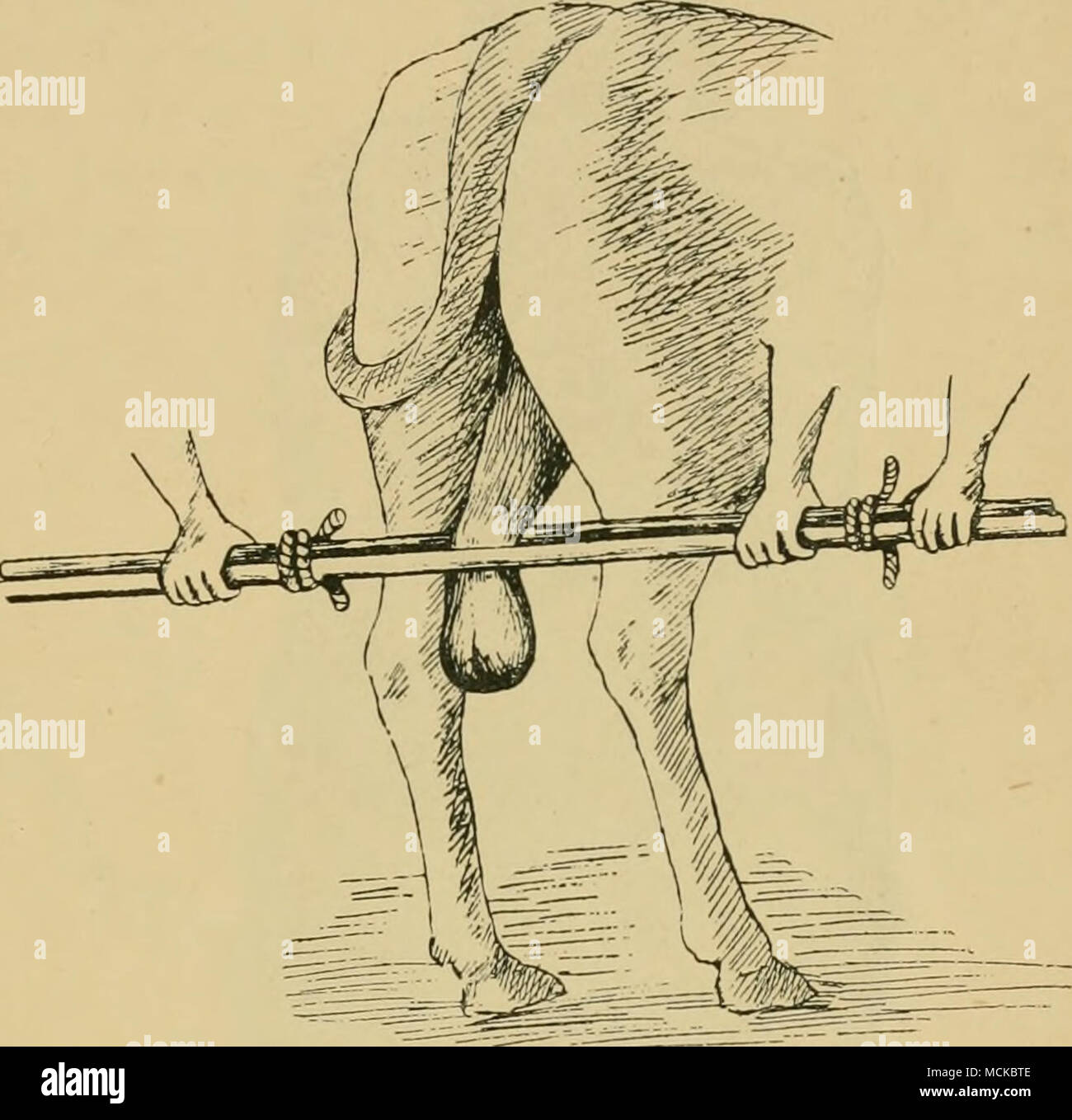 . Fig. 315.—Crushing the testicular cord. (This uiethod is to be strongly condennied.) CASTRATION BY TORSION. The cord may be twisted throughout its entire length or torsion may be limited to a part of the cord, hence the two methods here- after described. (a) Limited Torsion.—The testicles are exposed as in castration by the open method. The cord is then drawn forward and fixed by Stock Photo