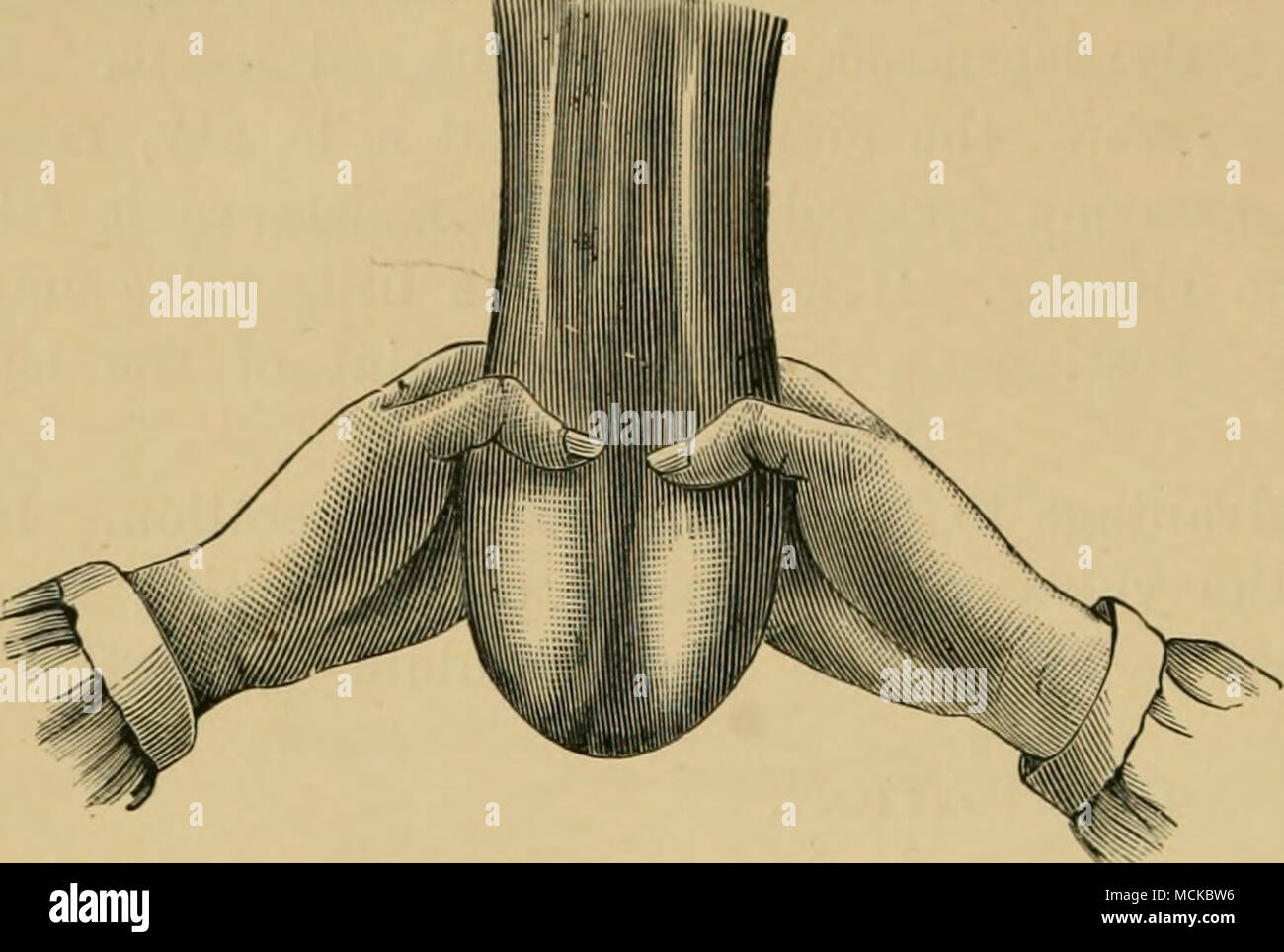 . Fig. 309.—Bistournage. First phase, the scrotum. Manipulatinc check movement of the hind legs. The hind legs are also partially secured by means of ropes or two pieces of webbing passed in a running noose about the hocks and fixed above the knee. No preliminary disinfec- tion is practised, be- cause no wound is made. Manual Technique. The operation com- prises four stages : First stage. The operator, standing be- hind the animal's hocks, grasps the testicular cords with the hands, immediately above the testicles, and by exercising strong pressure, thrusts the latter to the extreme base of th Stock Photo