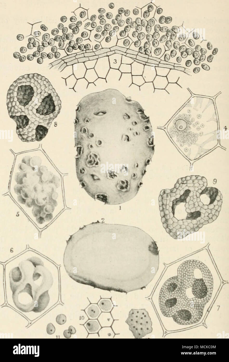 . Fig. 159.—Spongospora scabies. 1, tuber showing wuunds made during early development of the parasite; 2, section of same potato; 3, miture spore- balls of Spongospora ; 4, amoeboid bodies of Spo&gt;igospora in a potato cell, the starch has already disappeared; 5, showing the amoeboid bodies fused to form a Plasmodium in a ]&gt;otato cell; 6, a more advanced stage of the Plasmodium ; 7, the ()lasmodium in a still more advanced staj;e, showing its substance broken up into a layer of spores forming a 'spore-ball'; 8 and 9, free spore-balls that have escaped from the cells of the potato; 10, cel Stock Photo