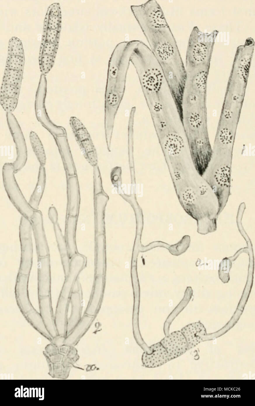 . Fig. ^o.—IIi-tcrosporium cchinulatum. i, portion of a diseased carnation ; 2, cluster of conidiophores bearing coniiiia; 3, conidium germinating, and producing secondary spores. Figs. 2 and 3 highly mag. leaves of a plant are attacked, owing to the spores being washed from one leaf to another. When the fungus is mature the tissue of tlie injured spots becomes brown, and often crumbles away leaving a hole. On cultivated species of Auricula. Excess of moisture favours the parasite. Spray with potassium sulphide and ventilate well. Stock Photo
